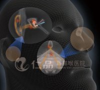 Yefine技术
