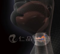 迹