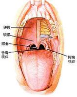 慢性咽炎怎么食疗