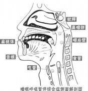 女性打呼噜怎么治疗