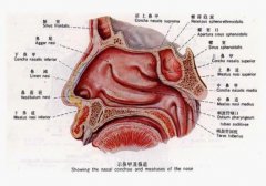 慢性鼻炎如何预防
