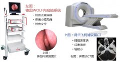 南京做鼻息肉手术哪家医院治疗效果好